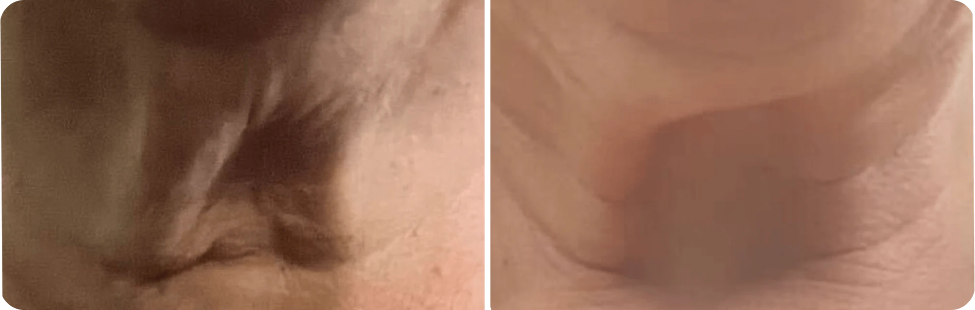 Slider image 3