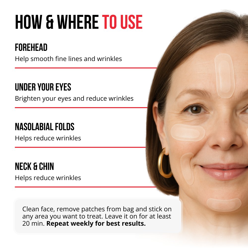 Self-dissolving Microneedle Patches