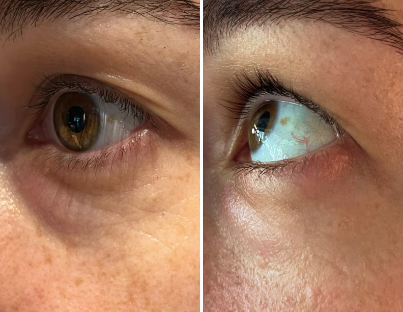 Customer result